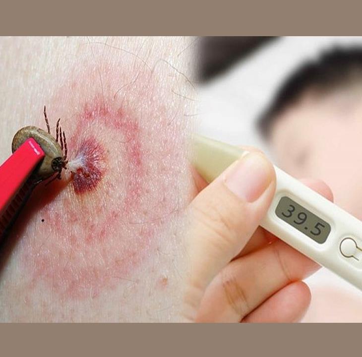 Vien Tri Ve Ran Pet (4) (Medium)